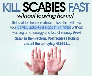 Scabies Remedies